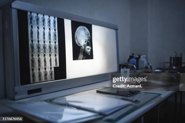 illuminated light box displaying x-rays in tokyo hospital - lightbox stock pictures, royalty-free photos & images