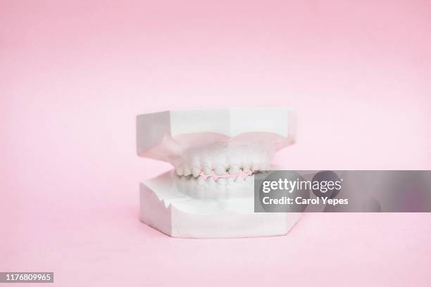 dental teeth model on pink background - plaque bacteria stock pictures, royalty-free photos & images