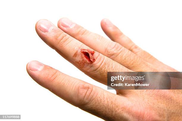 cut finger - knuckles stock pictures, royalty-free photos & images
