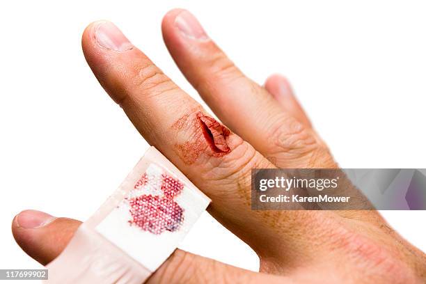 bleeding wound - cut on finger stock pictures, royalty-free photos & images