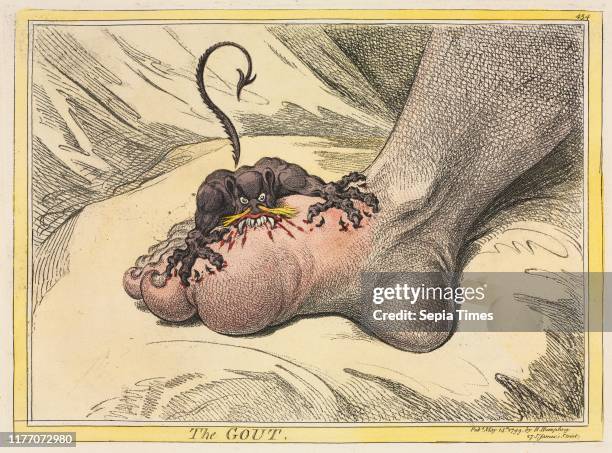 The Gout, 1799. James Gillray , Hannah Humphrey. Etching hand-colored with watercolor ; sheet: 32.3 x 46.5 cm ; platemark: 26 x 36.5 cm .