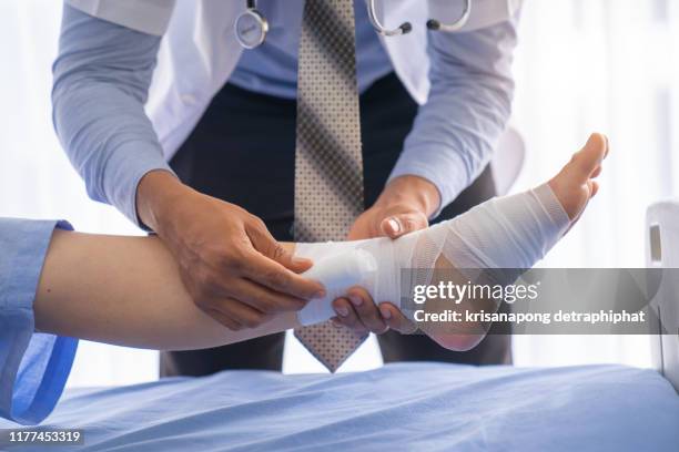 broken leg patient on the bed ,doctor or physiotherapist giving the expert treatment to the broken leg patient on the bed for a good recovery,patient with knee problem at consulting room - wounded photos et images de collection