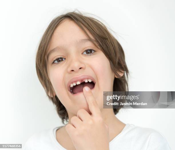 little boy with milk tooth - gencive photos et images de collection