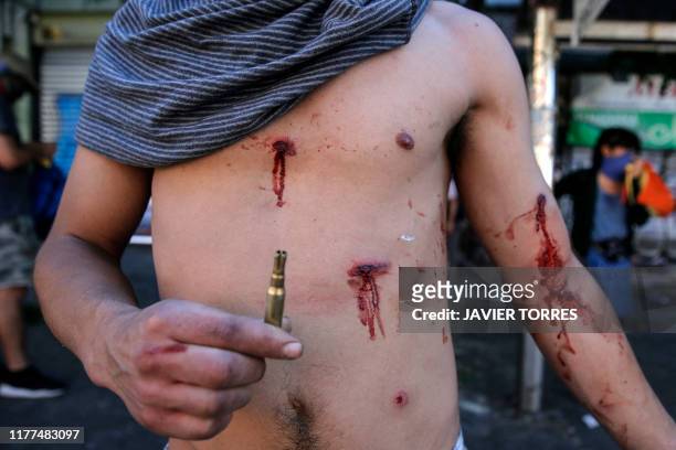 Protester shows his wound after he was hit by rubber bullets during clashes with security forces on a fourth straight day after protests against a...
