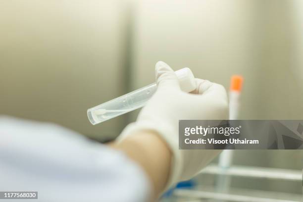 doctor examining the urine in laboratory - drug test - fotografias e filmes do acervo