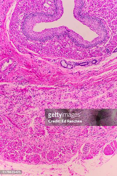 microanatomy (histology) of the esophagus, human 25x - plaveiselcelepitheel stockfoto's en -beelden