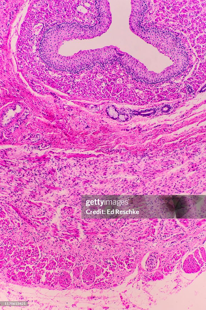 MICROANATOMY (HISTOLOGY) of the ESOPHAGUS, Human 25X