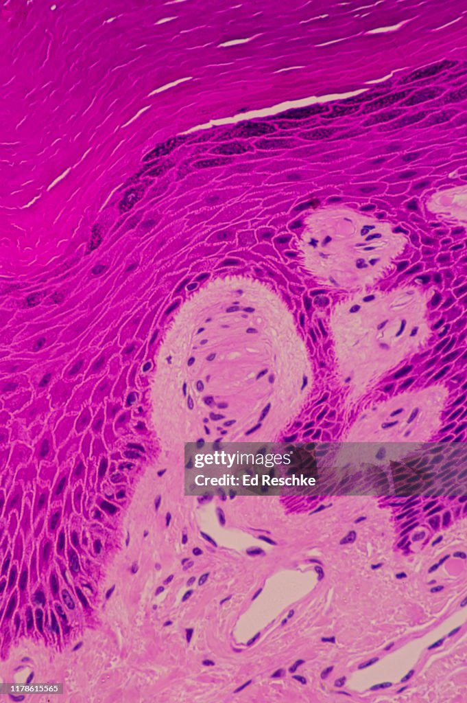 TACTILE SENSORY RECEPTOR--PACINIAN CORPUSCLE in the DERMIS of the SKIN, 250X