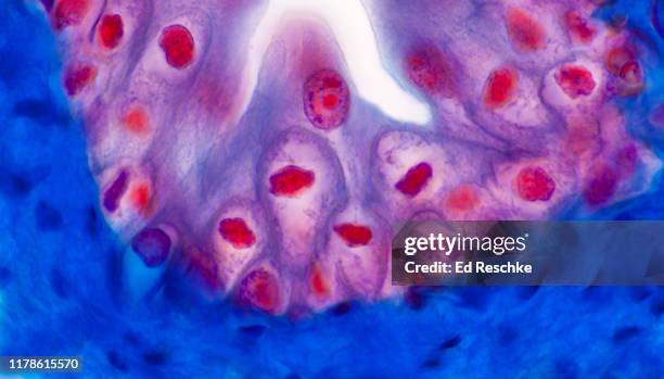 transitional epithelium--lining the urinary bladder, 250x - blase harnapparat stock-fotos und bilder