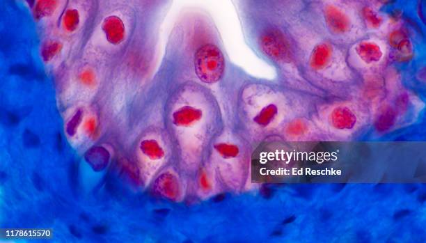 transitional epithelium--lining the urinary bladder, 250x - epitelio imagens e fotografias de stock
