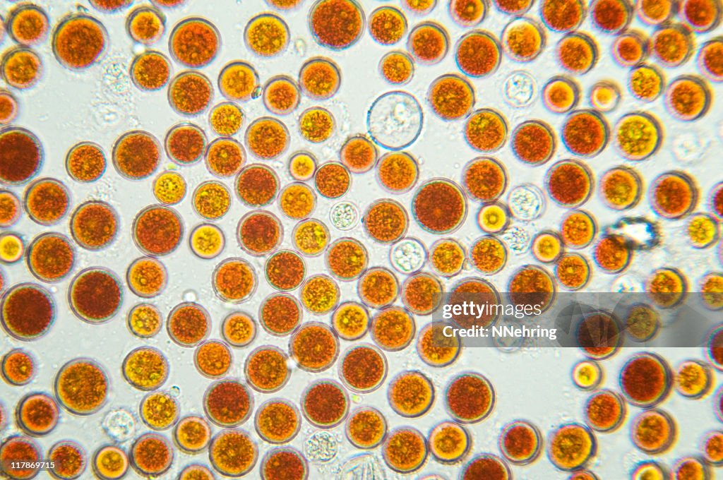 Algae, Haematococcus pluvialis, micrograph