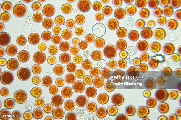 algae, haematococcus pluvialis, micrograph - astaxanthin stock pictures, royalty-free photos & images