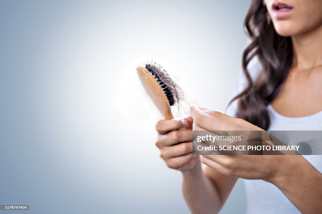 Female hairloss