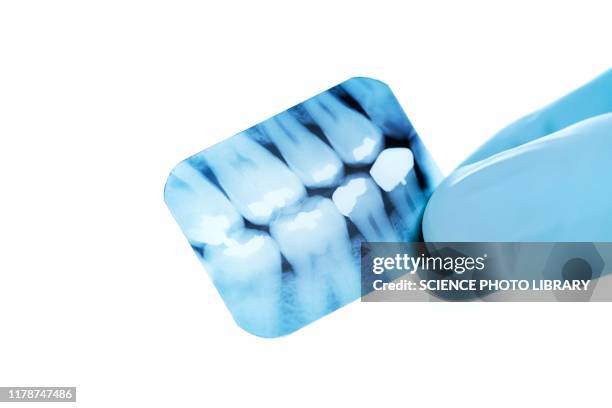 dental x-ray - vulling tandartsapparatuur stockfoto's en -beelden