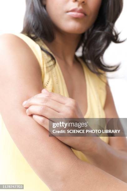 woman scratching her arm - insect bites images - fotografias e filmes do acervo