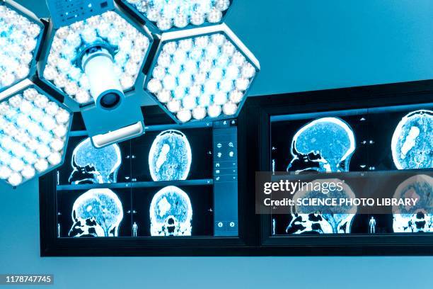 surgical light and monitors in operating theatre - neurosurgery stock-fotos und bilder