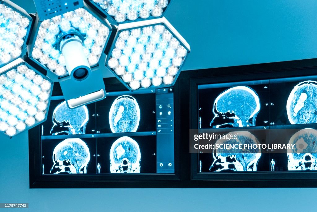 Surgical light and monitors in operating theatre