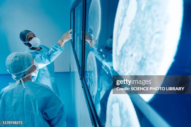 surgeons looking at mri scans during surgery - digital healthcare stock pictures, royalty-free photos & images