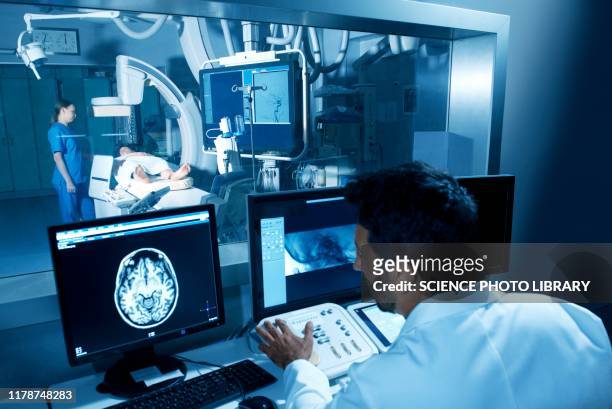 angiogram examination - radiogram stockfoto's en -beelden