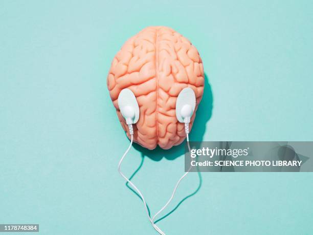 brain stimulation, conceptual image - elétrodo imagens e fotografias de stock