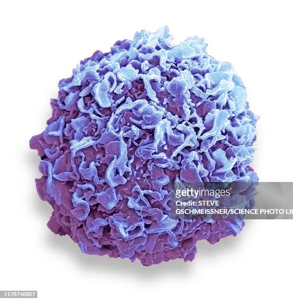 breast cancer cell, sem - sem human chromosomes stock pictures, royalty-free photos & images