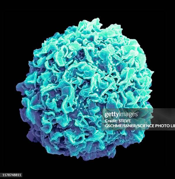 breast cancer cell, sem - sem human chromosomes stock pictures, royalty-free photos & images