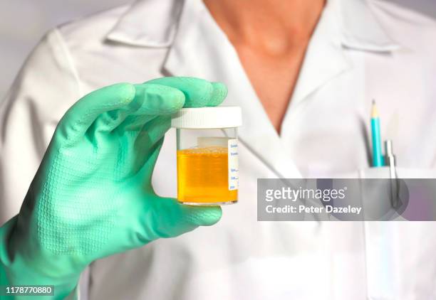 doctor with athlete/sportsman's urine sample - doping fotografías e imágenes de stock