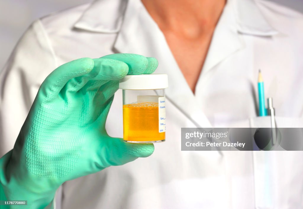 Doctor with athlete/sportsman's urine sample