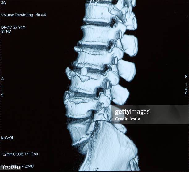 computerized tomography - diagnostic medical tool stock pictures, royalty-free photos & images