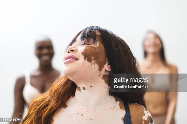 beautiful women portrait in studio - vitiligo stock pictures, royalty-free photos & images