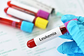 Blood for leukemia cells test