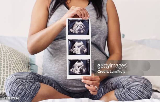 dit is de eerste foto van mijn bundel van vreugde - ultrasound scan stockfoto's en -beelden