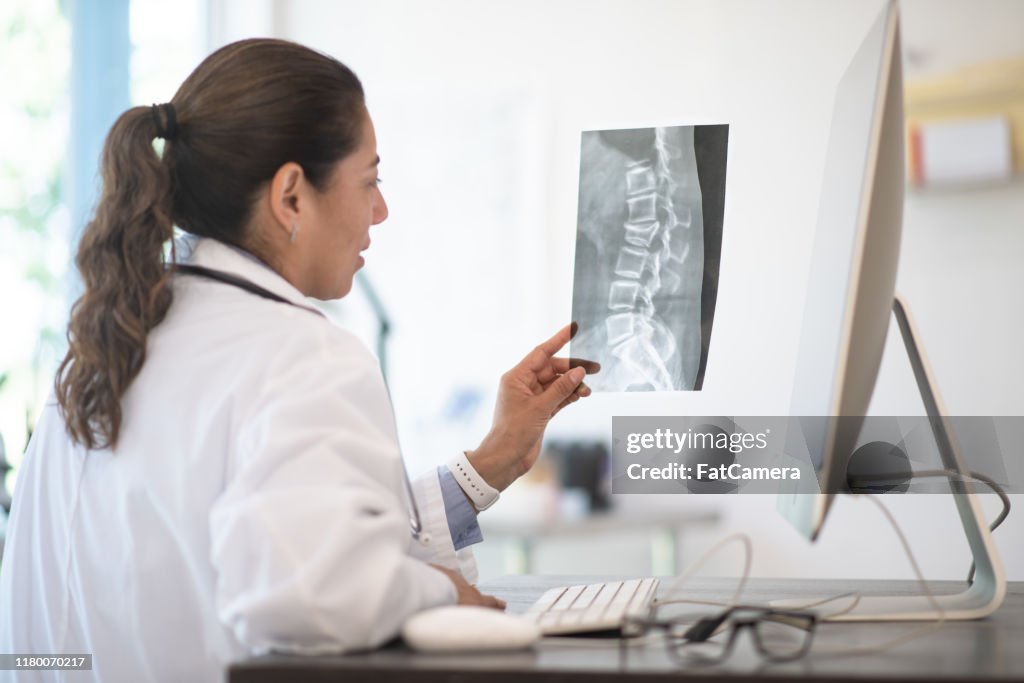 Ein Arzt überprüft Röntgenergebnisse Stockfoto