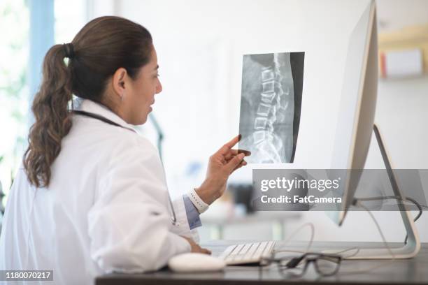 a doctor reviewing x-ray results stock photo - backbone stock pictures, royalty-free photos & images