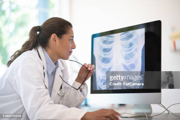 un medico che esamina la foto d'archivio dei risultati dei raggi x - chest foto e immagini stock