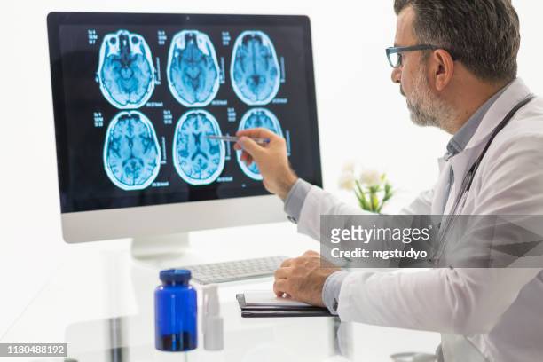 männer arzt untersuchung gehirn mr - brain scan stock-fotos und bilder