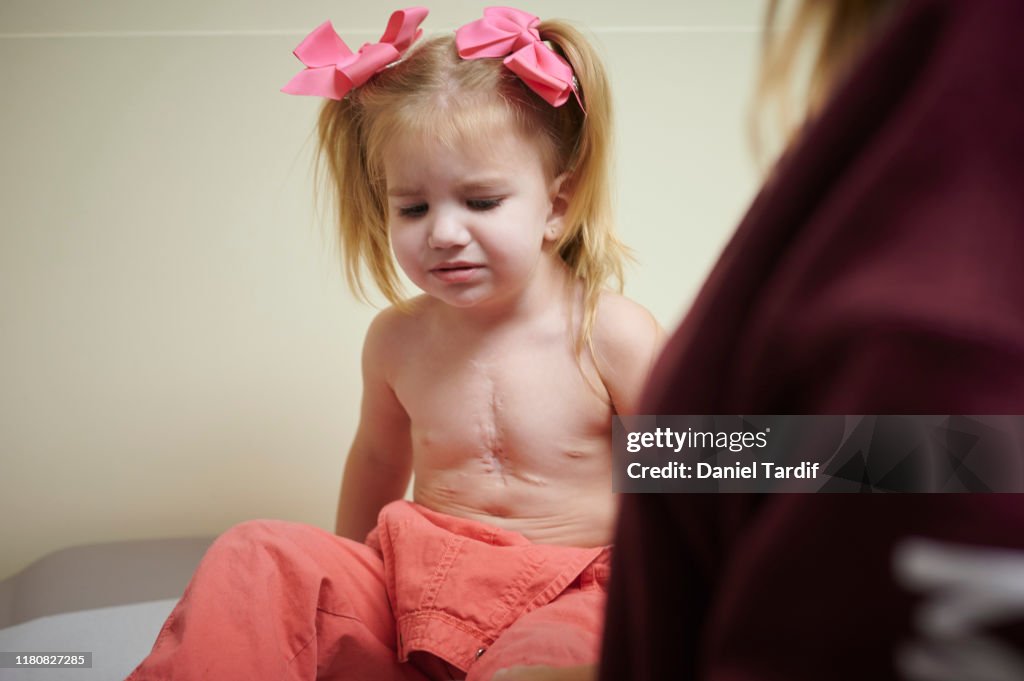2 year old open heart surgery survivor getting check-up.