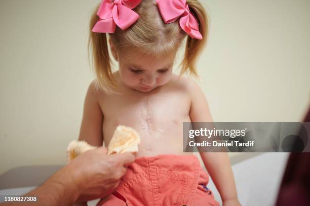 2 year old open heart surgery survivor getting check-up. - heart surgery scar stock pictures, royalty-free photos & images