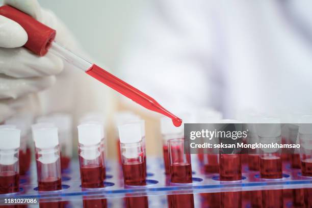laboratory assistant analyzing a blood sample - hematología fotografías e imágenes de stock