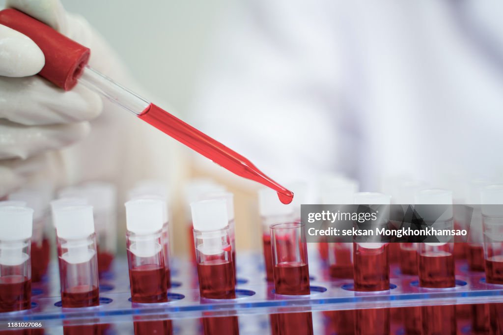 Laboratory assistant analyzing a blood sample
