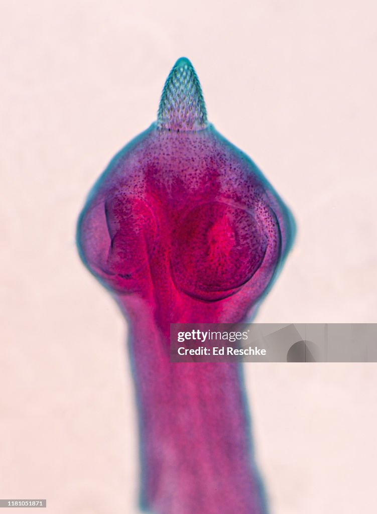 DOG TAPEWORM (Dipylidium caninum) SCOLEX WITH SUCKERS and ROSTELLUM with HOOKS, 25X