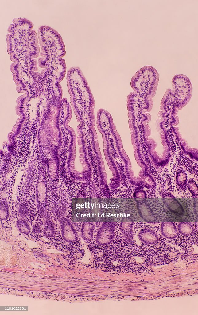 SMALL INTESTINE---VILLI in the DUODENUM and LAYERS: MUCOSA, SUBMUCOSA, MUSCULARIS, SEROSA, 25X