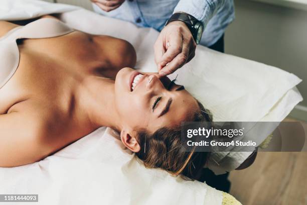 acupuncture and massage treatment - acupuncture needle stock pictures, royalty-free photos & images