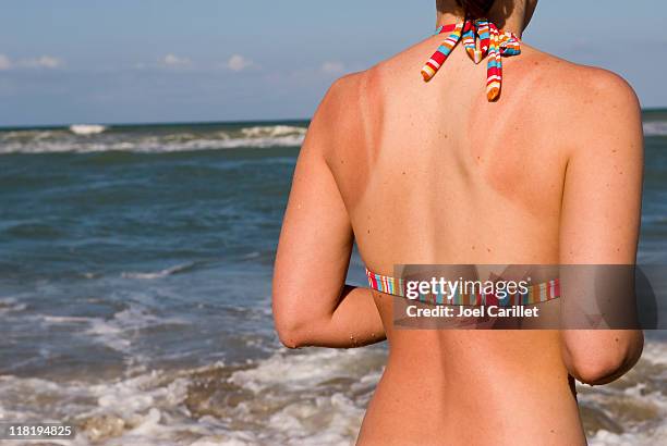 coup de soleil arrière à la plage - marque de bronzage photos et images de collection