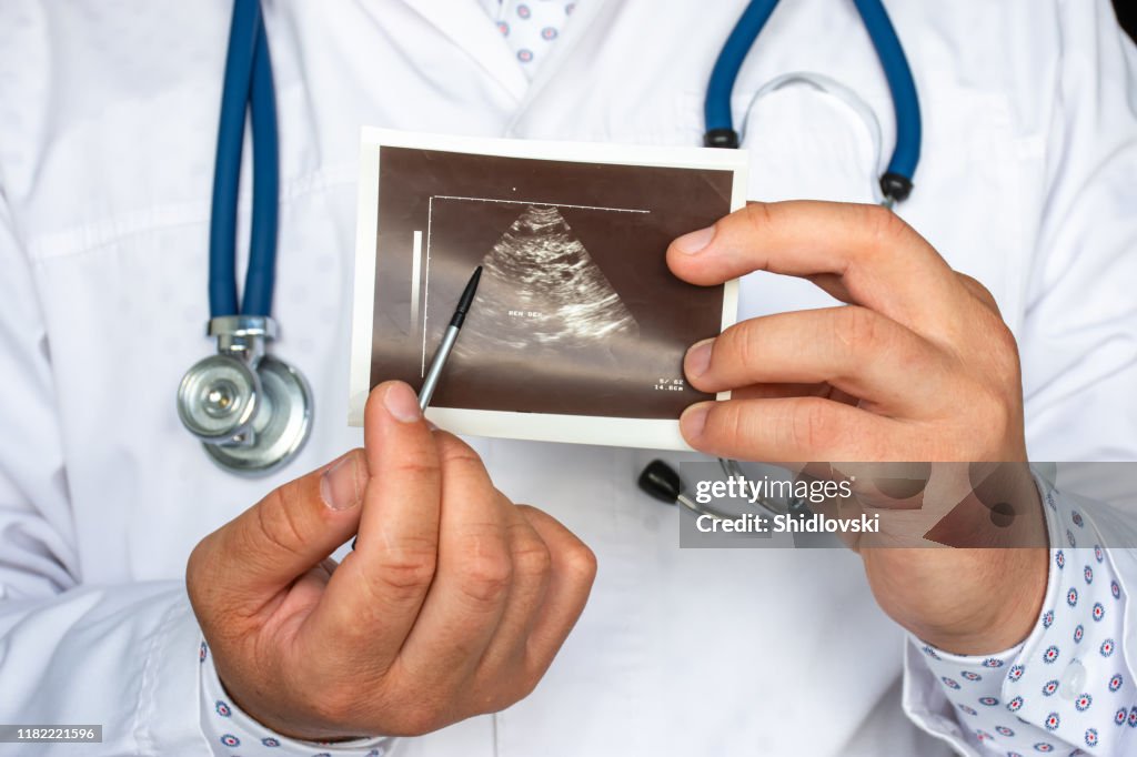 Polycystic kidney disease on ultrasound image concept photo. Doctor indicating by pointer on printed picture of ultrasound pathology of many cysts in kidneys. For diagnosis, radiology, nephrology