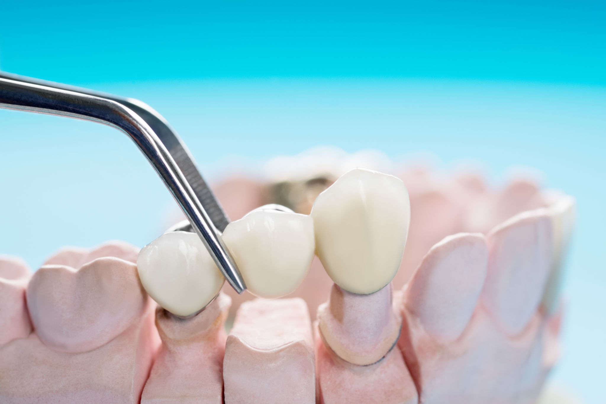Prosthodontics or Prosthetic Prosthodontics or Prosthetic