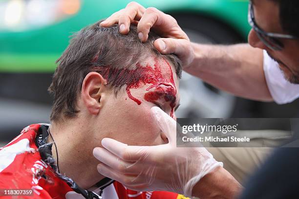 Janez Brajkovic of Slovenia and team Radioshack is dazed after a heavy fall during Stage 5 of the 2011 Tour de France from Carhaix to Cap Frehel on...