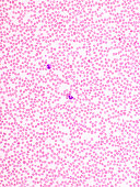 Picture of blood cells in blood film