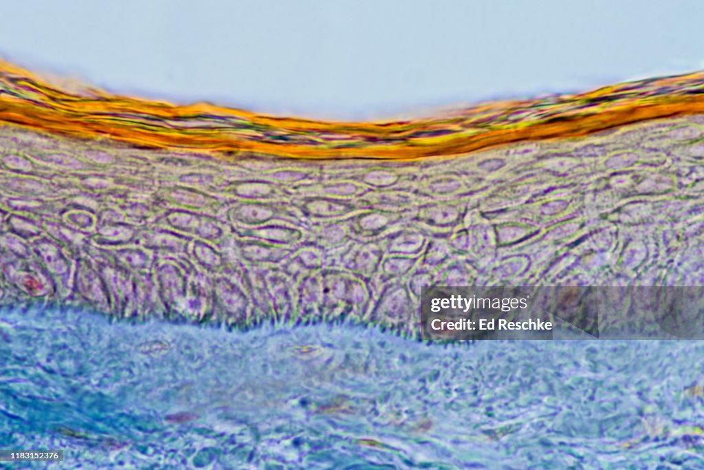 EPIDERMIS and DERMIS---Scalp, Human, 100X