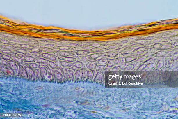 epidermis and dermis---scalp, human, 100x - stratified squamous epithelium stock pictures, royalty-free photos & images